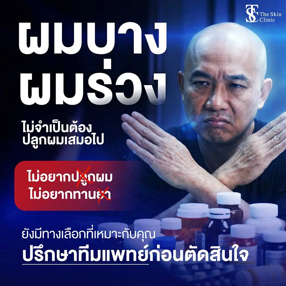 ผมบาง
